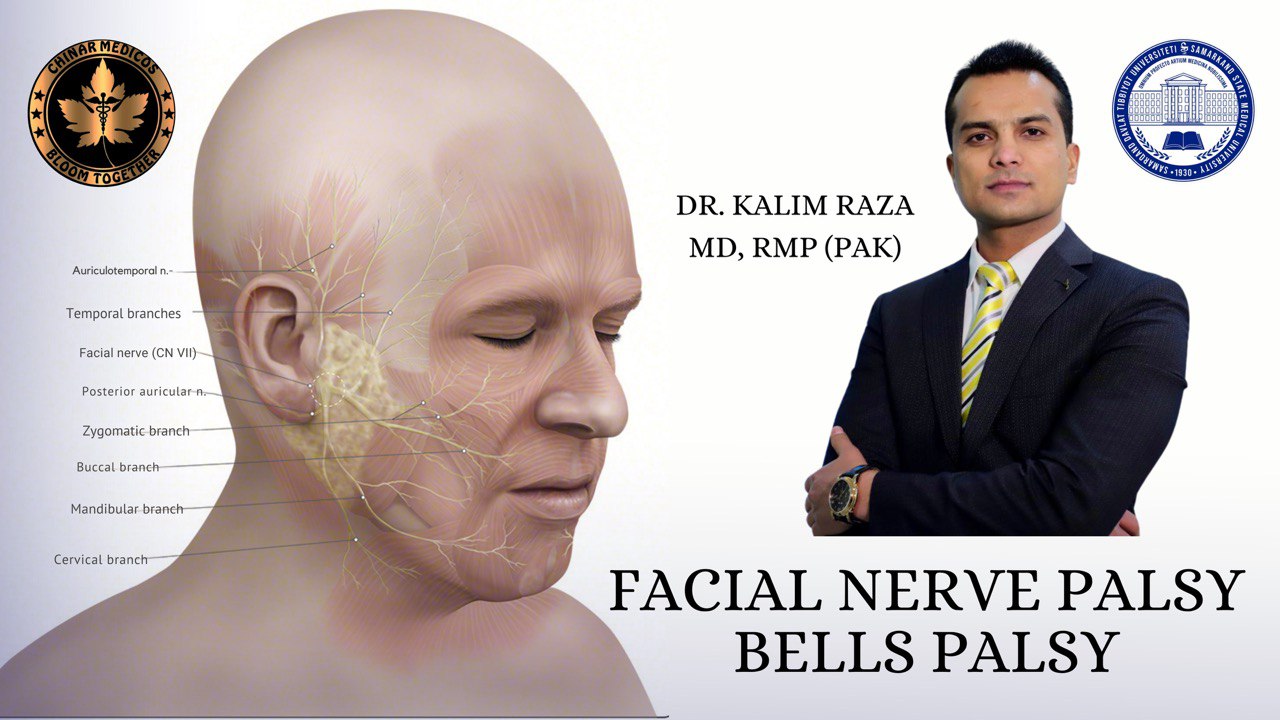 Bells palsy FACIAL NERVE PALSY